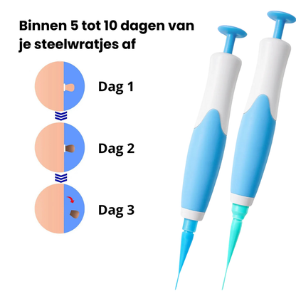 TackPen™ Kit | Verwijder steelwratjes veilig