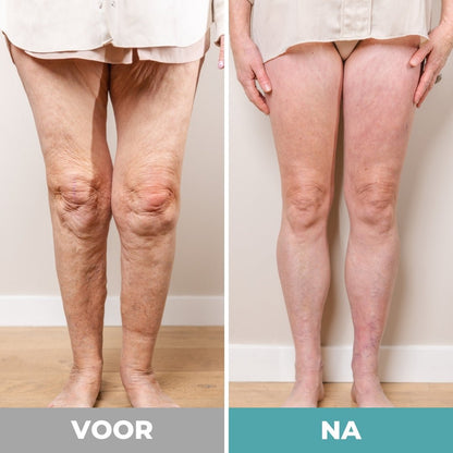 Serashock Voetmassager