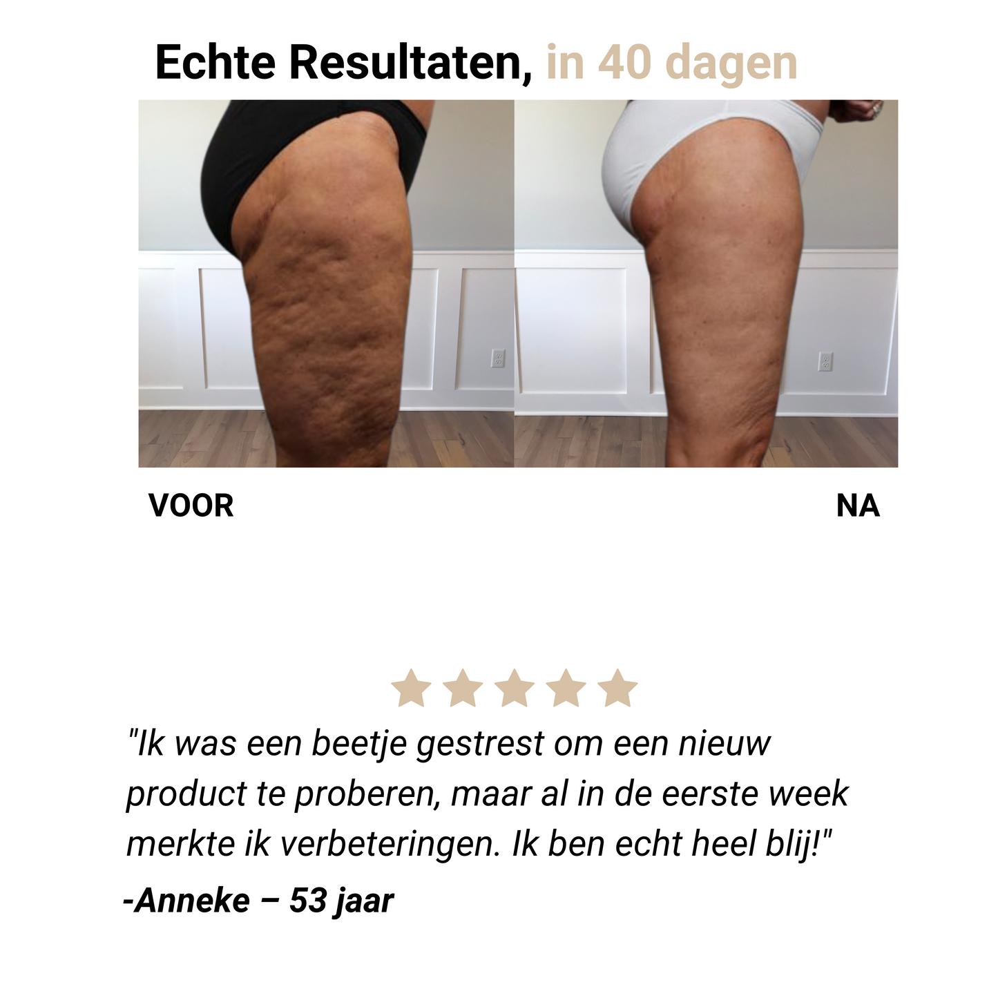 Celena® – Anti-Cellulite Massager voor Gladde Huid