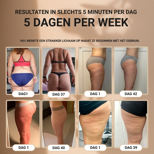 Celena® – Anti-Cellulite Massager voor Gladde Huid
